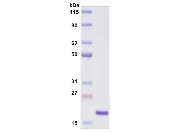 [MC12-025] Recombinant Human Siglec-9, His Tag -25 ug